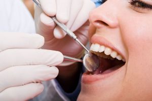 Dental Insurance in Costa Mesa, Orange County, CA
